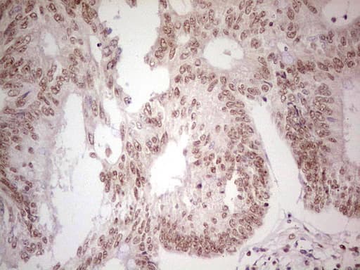 PPP1R8 / Rnase E Antibody (aa1-225, clone OTI2E12, Carrier-free)