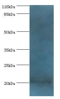 NTS / NT / Neurotensin Antibody (aa24-143)