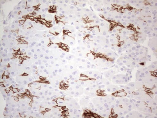 KRT19 / CK19 / Cytokeratin 19 Antibody (aa240-390, clone UMAB187, Carrier-free)