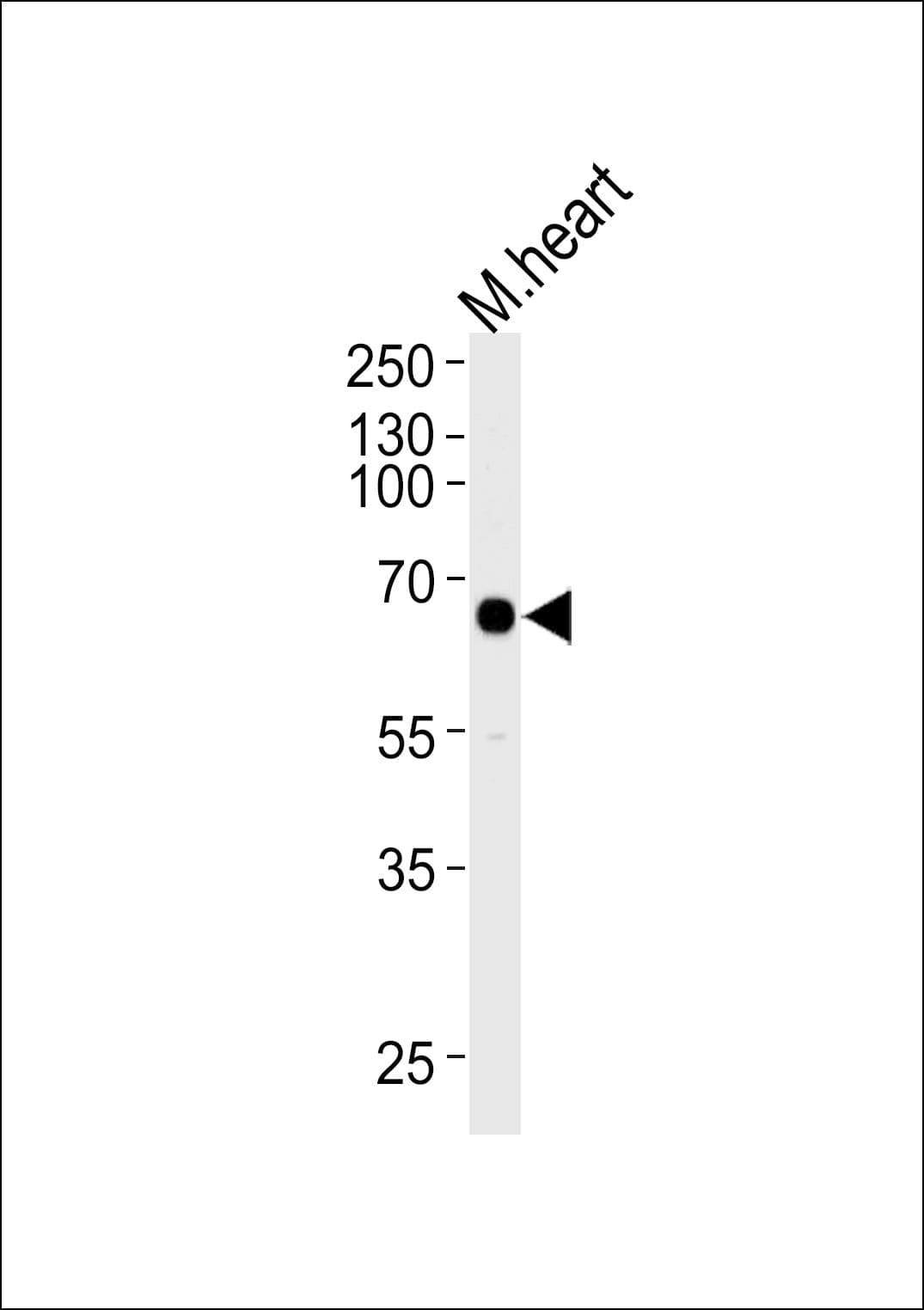MAPKAPK3 Antibody (aa63-90)