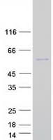 Human SEC62 / TP-1 Protein (Recombinant Myc-DDK (Flag))