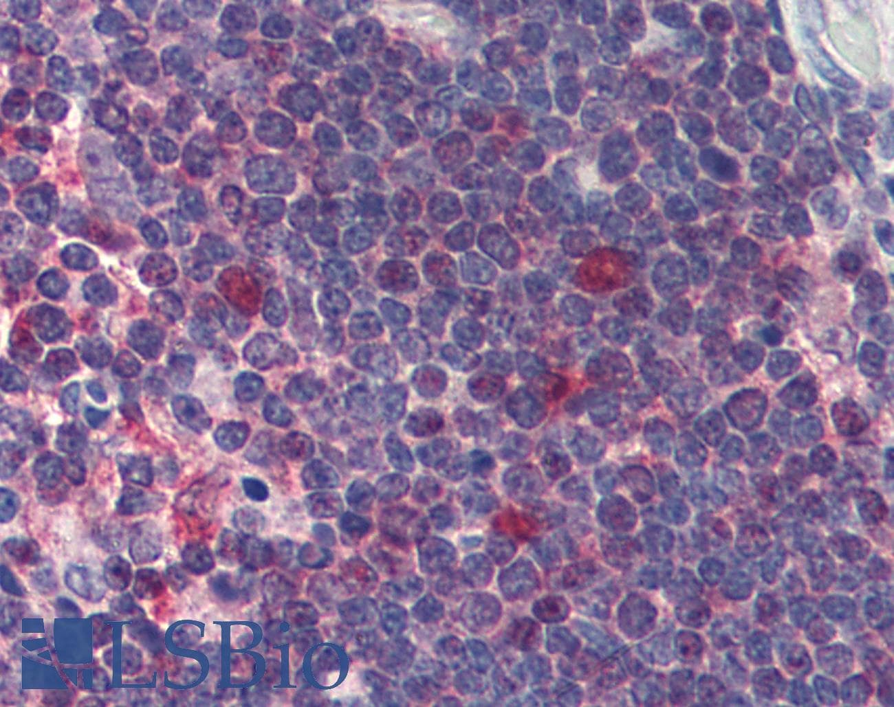IHC-plus™ CDK1 / CDC2 Antibody (clone POH-1)