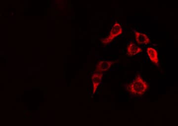 Polyclonal Rabbit anti-Human CLIP2 / CYLN2 Antibody (IF, WB)