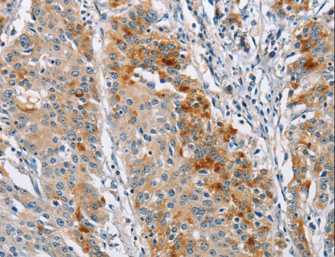 BCL10 / BCL-10 Antibody