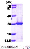 Human PSMB5 Protein (Recombinant His)