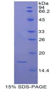Rat ADAMTS7 Protein (Recombinant His)