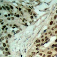 NAT5 / NAA20 Antibody