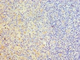 TRAIL-R4 / DCR2 Antibody (aa257-386)