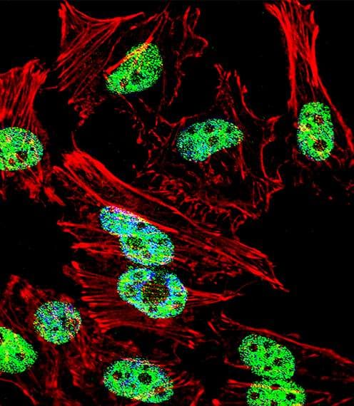 TBXT / T / Brachyury Antibody (aa15-43)