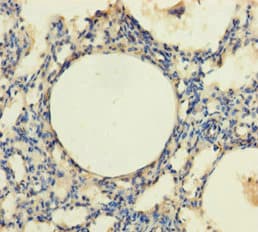 Polyclonal Rabbit anti-Human TRPM8 Antibody