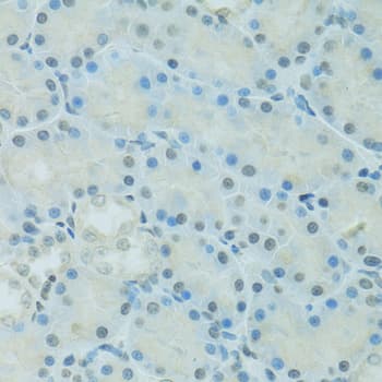 C/EBP Alpha / CEBPA Antibody