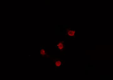 SKIL / SNO / SnoN Antibody