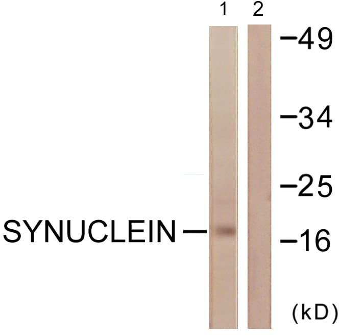 IHC-plus™ SNCA / Alpha-Synuclein Antibody (aa91-140)
