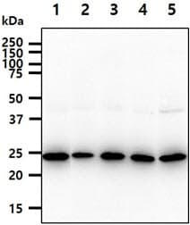 BAG2 Antibody (clone AT29E9)