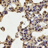 Polyclonal Rabbit anti-Human TPP2 Antibody (IHC, IF, WB)
