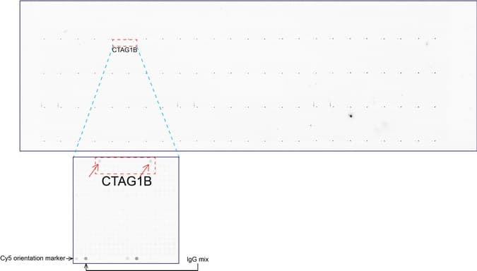 CTAG1B / NY-ESO-1 Antibody (clone UMAB73)