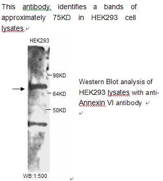 ANXA6/Annexin A6/Annexin VI Antibody