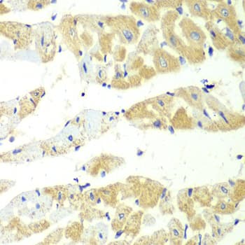IHC-plus™ TS / Thromboxane Synthase Antibody