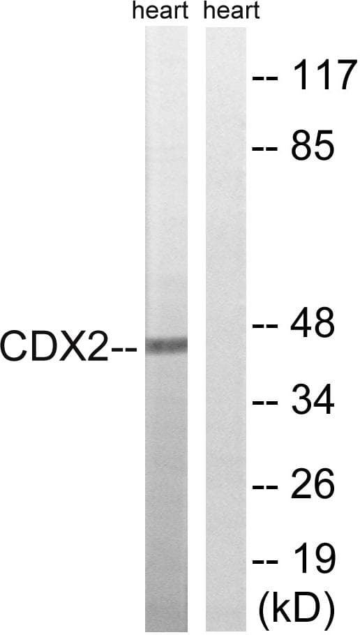 Polyclonal Rabbit anti-Human CDX2 Antibody (p283, WB)