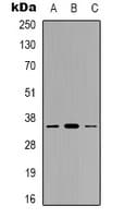 GGH / Gamma-Glutamyl Hydrolase Antibody (C-Terminus)