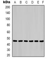 Monoclonal Mouse anti-Human KRT18 / CK18 / Cytokeratin 18 Antibody (IF, WB)