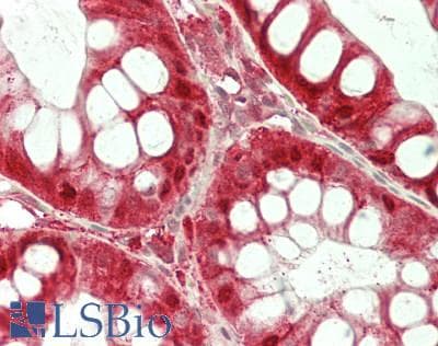 IHC-plus™ IDN3 / NIPBL Antibody (aa1025-1075)