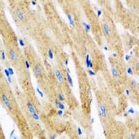 IHC-plus™ Polyclonal Rabbit anti-Human TPM3 Antibody (IHC, IF, WB)