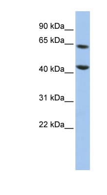 FOXJ3 Antibody (aa540-589)