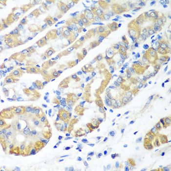 Polyclonal Rabbit anti-Human MSRB2 / MSRB Antibody (IHC, WB)