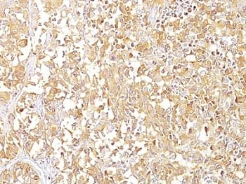 PMEL / SILV / gp100 Antibody (clone SPM142)