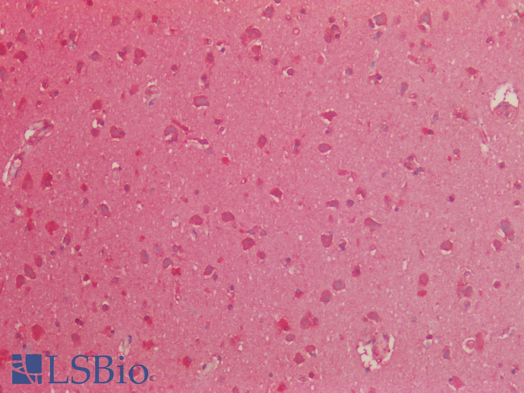 IHC-plus™ Polyclonal Rabbit anti-Human ISLET-1 / ISL1 Antibody (IHC, IF, WB)