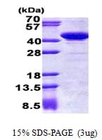 Human STBD1 Protein (Recombinant His)