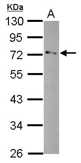 Polyclonal Rabbit anti-Human GPD2 Antibody (WB)
