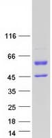 Human GC / Vitamin D-Binding Protein (Recombinant Myc-DDK (Flag))