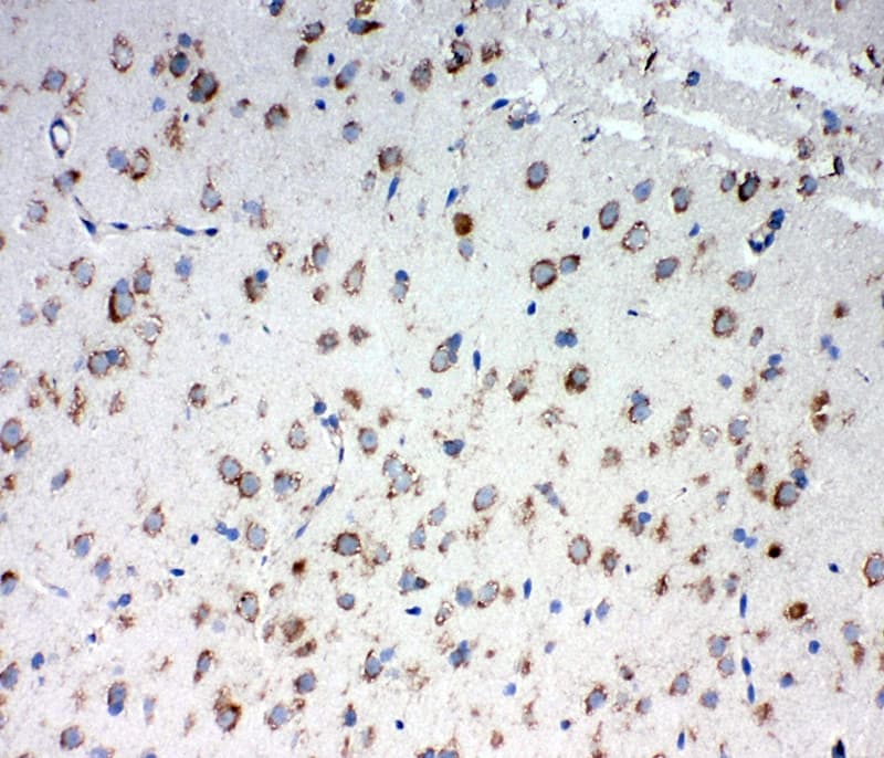 Polyclonal Rabbit anti-Human TRAM1 Antibody (aa314-331, IHC, WB)