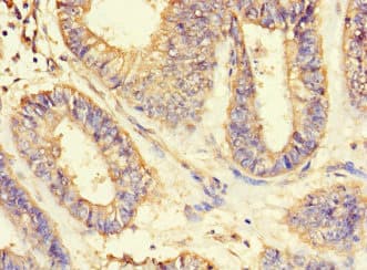 Polyclonal Rabbit anti-Human ASIP Antibody (IHC, IF)