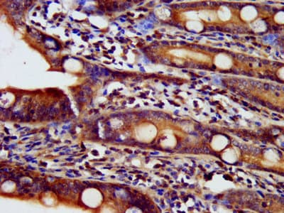 NDUFAF2 / NDUFA12L Antibody