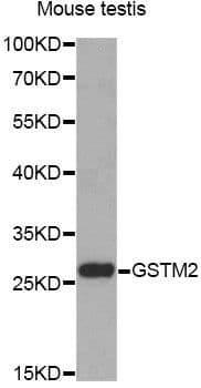 GSTM2 Antibody