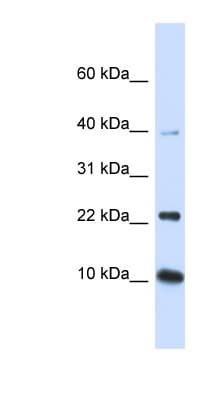UBE2D2 / UBCH5B Antibody (N-Terminus)