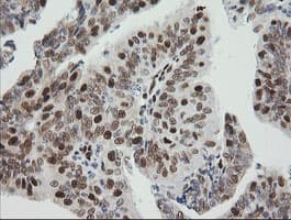 ZSCAN18 / ZNF447 Antibody (clone OTI1F10)