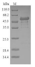Human NMNAT1 / NMNAT Protein (Recombinant GST, N-terminus)
