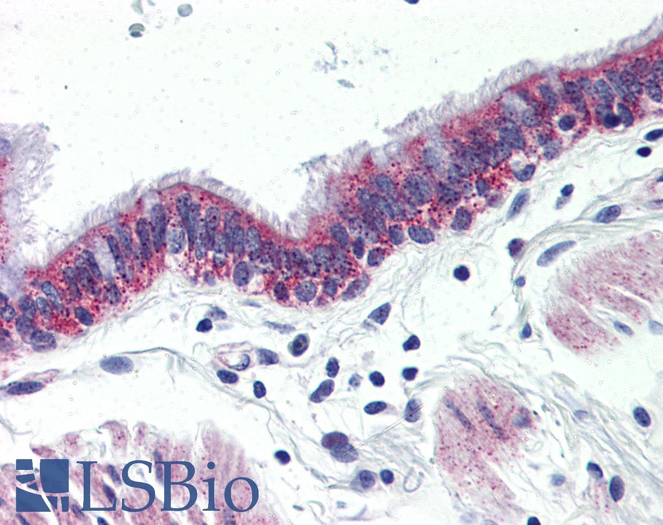 IHC-plus™ ADGRG6 / GPR126 Antibody (Internal)