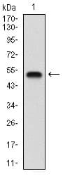 GABBR2 / GABA B Receptor 2 Antibody (aa319-483, clone 5G7F7)