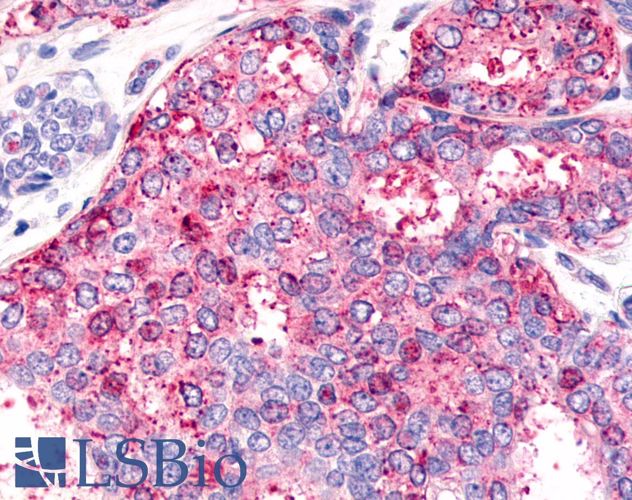 PathPlus™ HNF4G / HNF4 Gamma Antibody (Internal)
