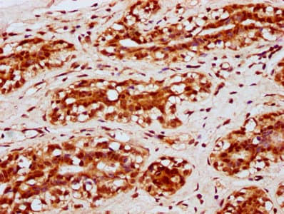 Polyclonal Rabbit anti-Human HIST1H2BN Antibody (IHC)