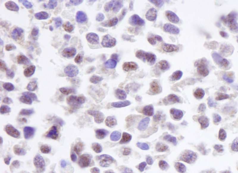 CSNK2A1 Antibody (aa300-350)