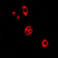 GALE / UDP-Glucose 4-Epimerase Antibody
