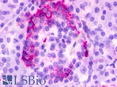 PathPlus™ GPR35 Antibody (Cytoplasmic Domain)