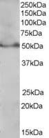 IHC-plus™ Polyclonal Goat anti-Human PPARD / PPAR Delta Antibody (aa430-441, IHC, WB)