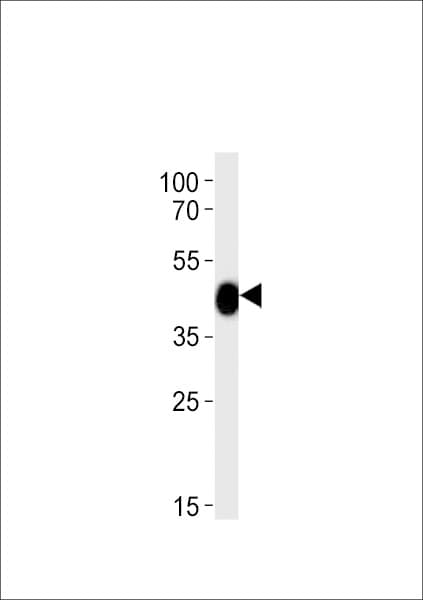 Polyclonal Rabbit anti-Zebrafish CHST11 Antibody (aa131-155, WB)